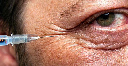 Gözde Yağ Bezesi Ameliyatı Riskleri ve Sonrası